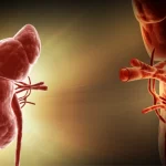 Kidney Transplant
